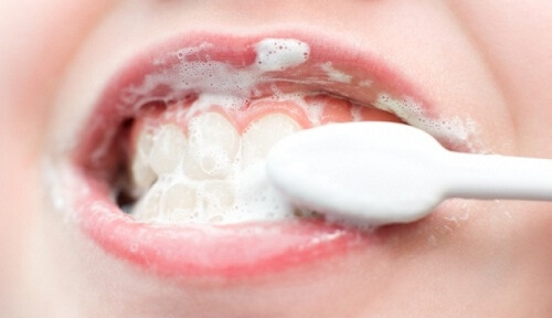 Albirea dinților prin tratamente naturiste preparate acasă