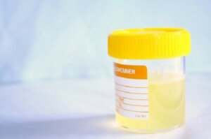 Ameliorează simptomele cistitei cu remedii naturale