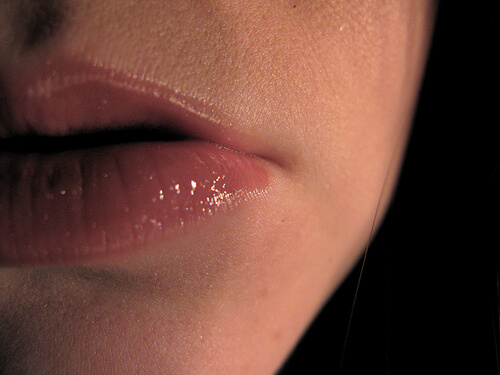 Gingii sensibile