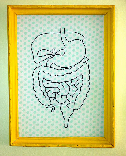 intestine diverticuloză