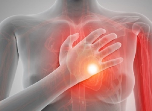 Stopul cardiac: se întâmplă fără simptome?