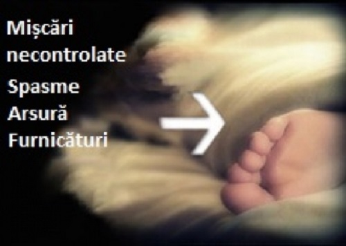 Cauzele furnicăturilor în mâini și picioare ca sindromul picioarelor neliniștite