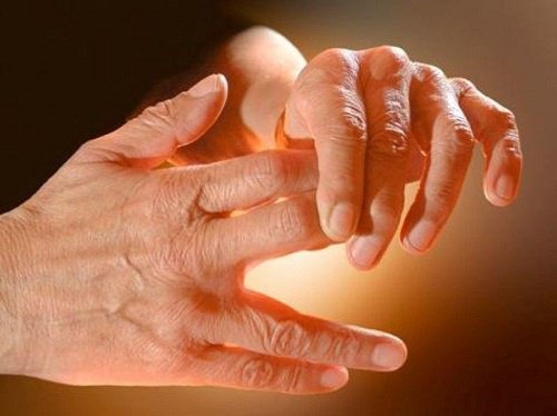 Amortirea mainilor sau picioarelor: cauze, simptome, tratament