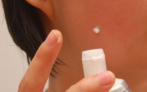 6 remedii făcute în casă care NU trebuie folosite
