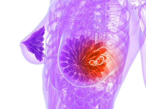 Semințele de in tratează constipația și cancerul