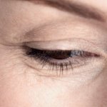 Tratament naturist pentru riduri in jurul ochilor - Ventussa