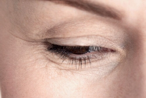 Cum să reduci aspectul ridurilor de sub ochi