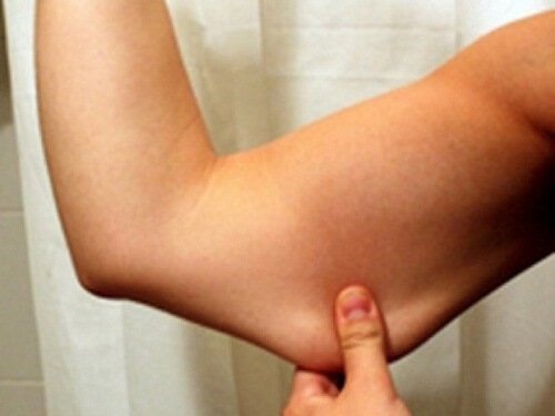 10 moduri de a pierde grăsimea încăpățânată a brațului - Pierdere În Greutate