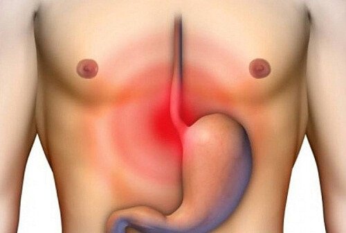 Inflamația esofagului: simptome