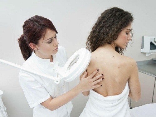 Medic care explică de ca apar alunițe roșii