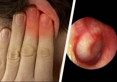 Cum să tratezi infecțiile urechii