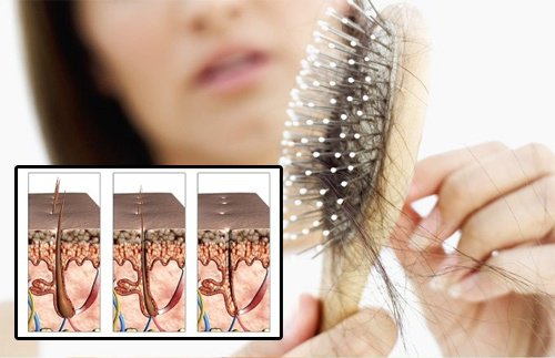 Căderea părului la femei – 9 cauze