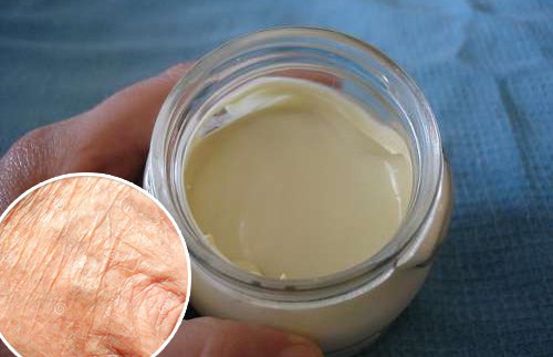 Cremă antirid făcută acasă Cremă antirid făcută acasă