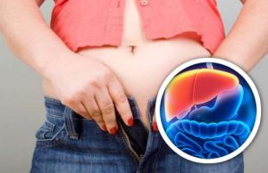 Slăbește prin detoxifierea ficatului