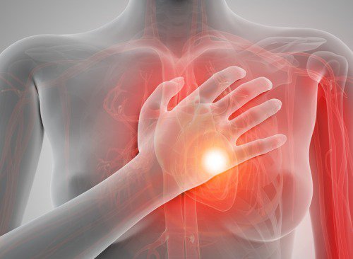 Infarct: stop cardiac