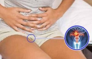 Semnele cancerului ovarian și depistarea acestora