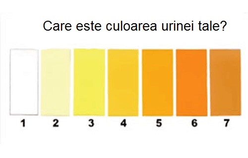 culoarea urinei in infectii urinare