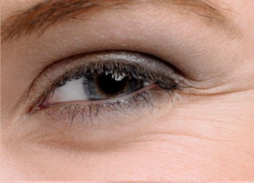 Tratamente pentru pielea din jurul ochilor