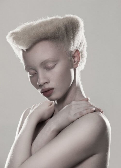 Albinismul afectează un fotomodel