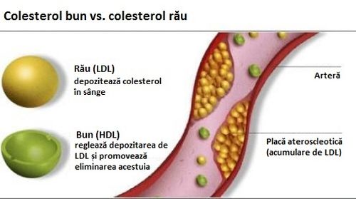 Apa de vinete ajută la reducerea colesterolului