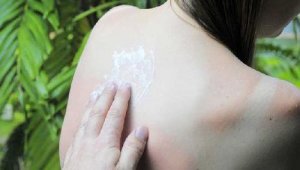 Expunerea la soare: cum să-ți aperi pielea