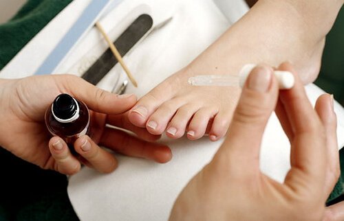 Cum tratezi unghiile încarnate de la picioare