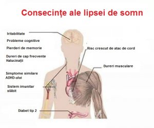 Lipsa somnului are consecinţe grave pentru sănătate