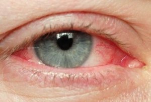 crema ochi iritati Werbung cremă anti-îmbătrânire