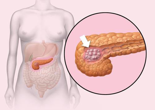 Sfaturi pentru a avea un pancreas sănătos