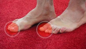 6 modalități să reduci nivelul de acid uric