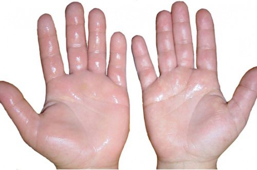tratamentul articulației umflate a mâinii)