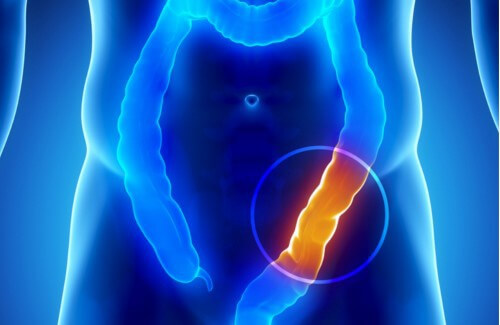 Afecțiunile colonului - 8 lucruri pe care trebuie să le știi