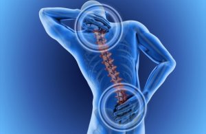 Durerile de spate – cele mai frecvente cauze