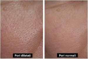 3 măști naturale pentru porii dilatați