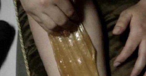 Pilozitatea excesivă îndepărtată cu ceară