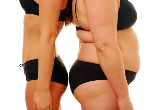Obezitatea poate conduce la boli de ovare