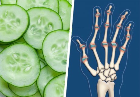 tratamentul osteoartrozei articulațiilor mâinilor Tratamentul articulațiilor la murături