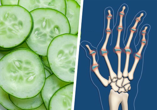 Dietă care ameliorează durerile articulare nocturne