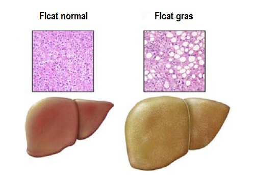 Ficatul gras și cauze ale acestuia