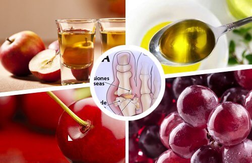 Sfaturi și remedii naturale pentru gută