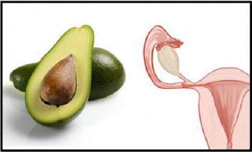 Fructele de avocado intră în categoria de alimente sănătoase esențiale