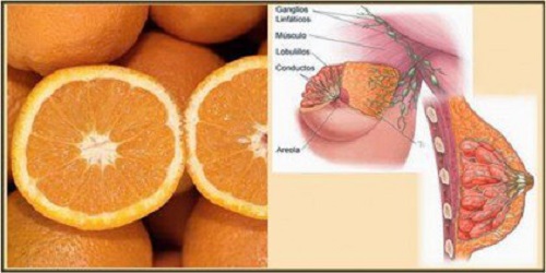 Portocalele intră în categoria de alimente sănătoase anticancerigene