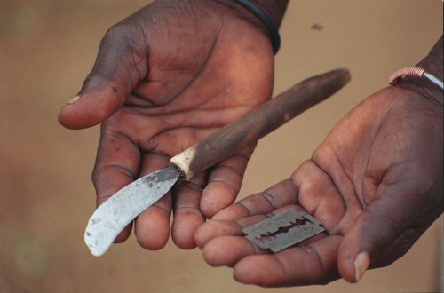 Circumcizia la femei este efectuată în condiții igienice precare
