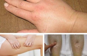 8 diuretice naturale pentru retenția de apă