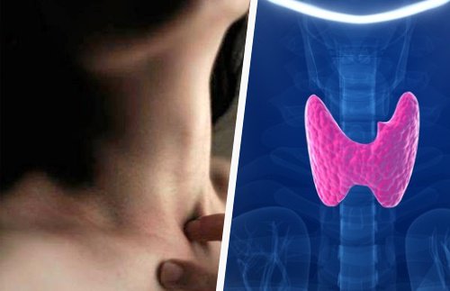 6 obiceiuri ce pot cauza probleme la glanda tiroidă