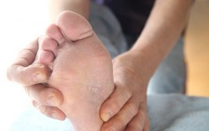 Piciorul de atlet: prevenire și tratament