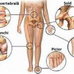 tratament cu miere pentru durerile articulare deteriorarea meniscului extern al tratamentului articulației genunchiului