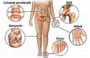 tratamentul artrozei durerii articulare