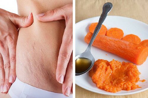 Tratament pentru vergeturi pe bază de morcovi