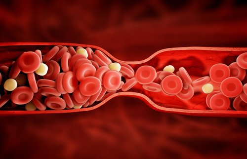 Avantajele curcumei versus medicamente